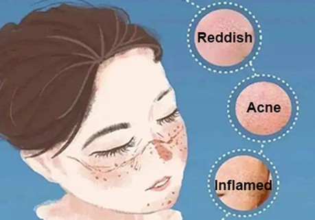 anti-inflammatory anti-inflammatory